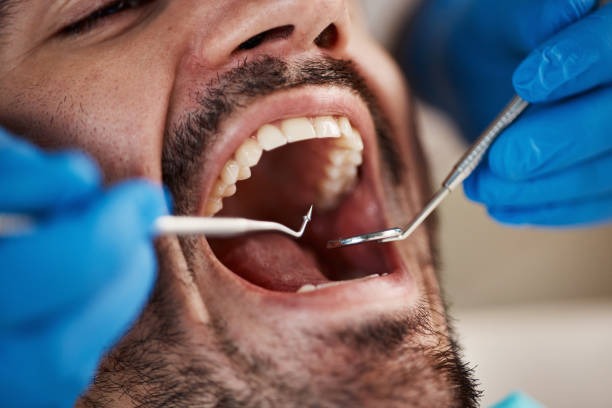 Best Weekend Emergency Dentist in Anacortes, WA